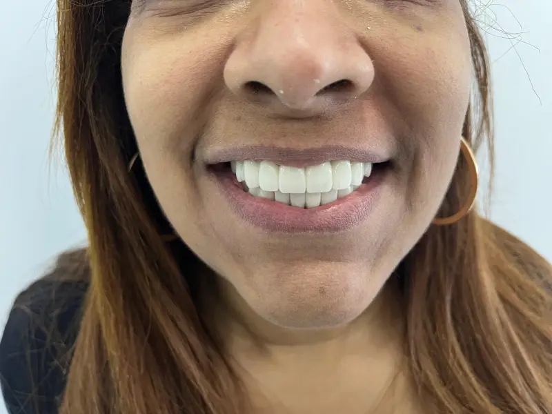 Mutlu hastalar ve diş kliniği personeli Türkiye